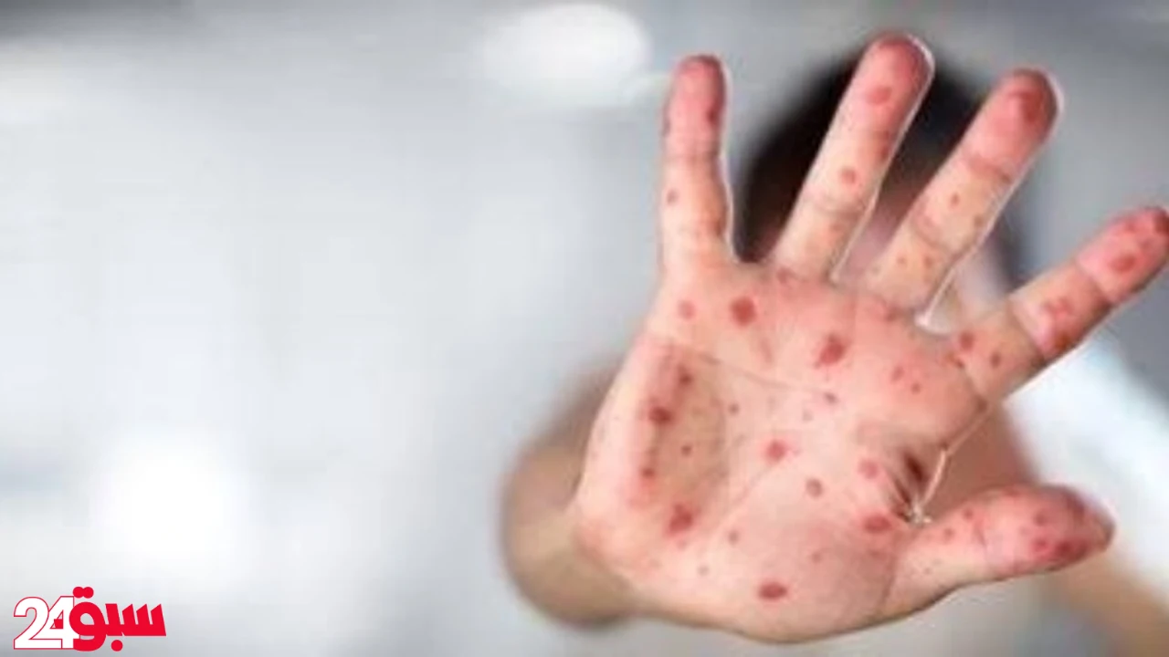 فيروس المدارس يغلق الحضانات.. علامات إصابة مبكرة بطفلك عليكِ معرفتها فورا